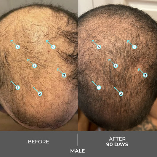 Extra Strength Hair DENSITY Shampoo
