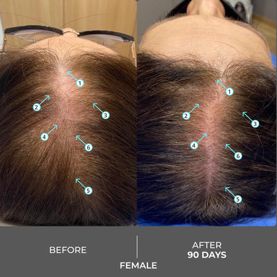 Extra Strength Hair DENSITY Shampoo