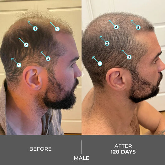 Extra Strength Hair DENSITY Shampoo